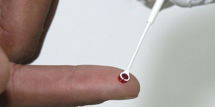 Pesquisadores da Fiocruz analisam coinfecção por HIV e HTLV na Bahia