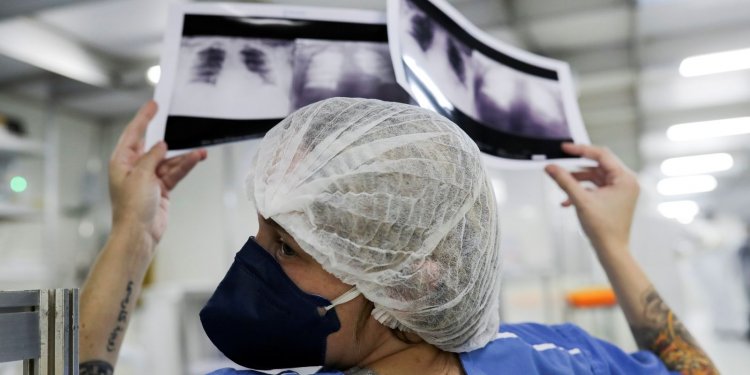 Médico alerta para riscos da tuberculose pulmonar não tratada