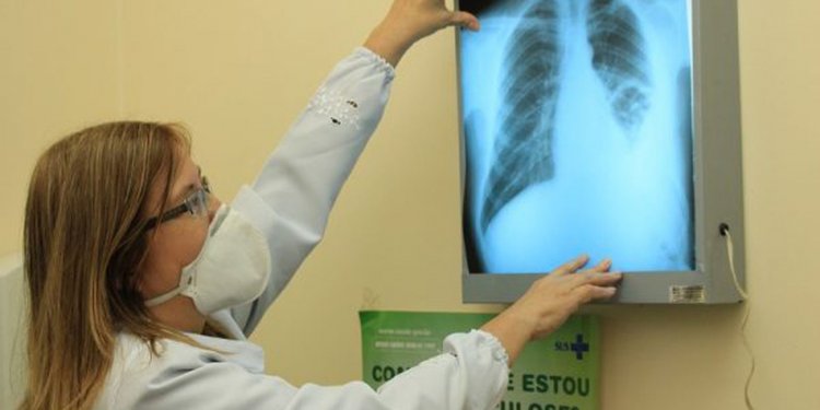 RJ, Acre e Amazonas lideram ranking de mortes por tuberculose no país
