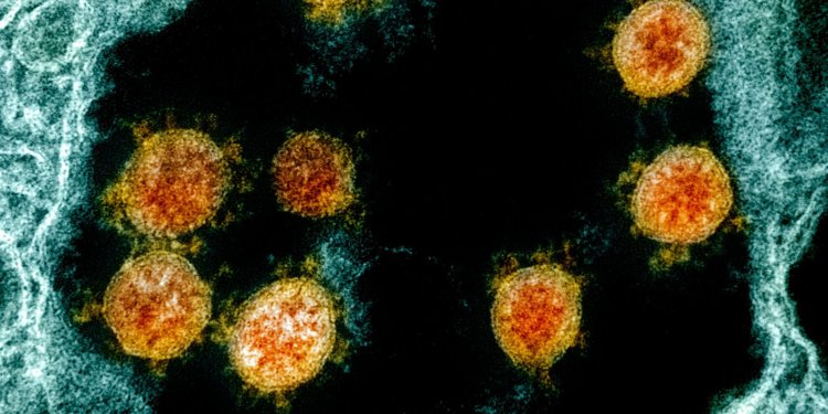 Fiocruz e Harvard explicam em estudo inflamação excessiva da covid-19