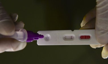 Brasil registra 27.796 casos de covid-19 e 114 mortes em 24 horas