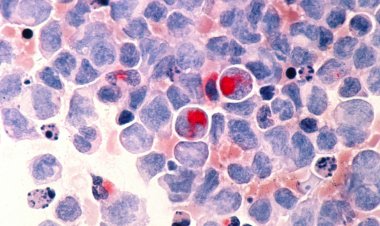 São Paulo lança programa de terapia celular para tratamento de câncer