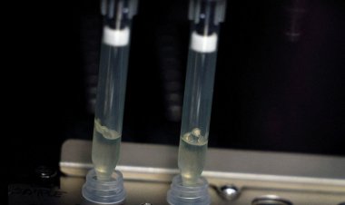 Laboratório da Fiocruz será referência em varíola dos macacos