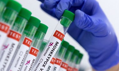 Primeiro infectado com varíola dos macacos recebe alta em SP