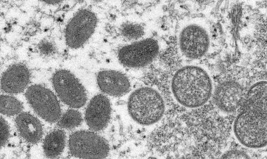 Fiocruz conclui sequenciamento genético do vírus Monkeypox