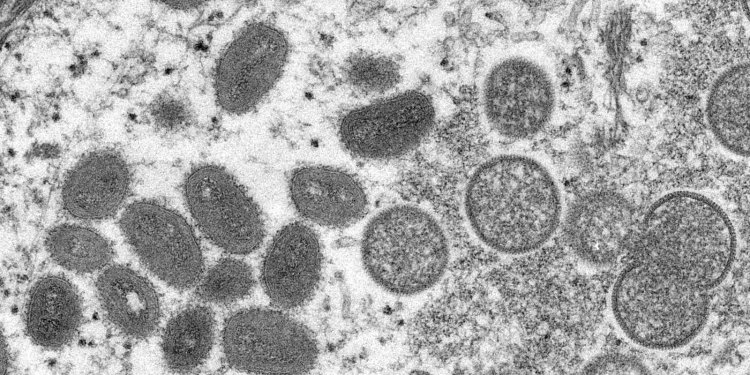 Fiocruz conclui sequenciamento genético do vírus Monkeypox
