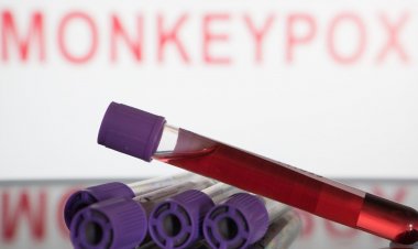 São Paulo lança plano de enfrentamento à varíola dos macacos