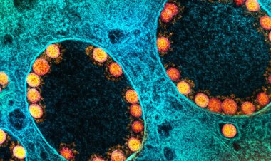 São Paulo registra primeira morte pela variante BQ.1.1 da covid-19 