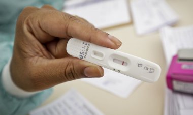 Rio de Janeiro registra 2 mil casos de covid-19 diariamente