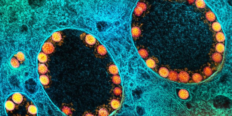 São Paulo registra primeira morte pela variante BQ.1.1 da covid-19